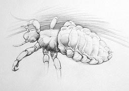 Kopflaus